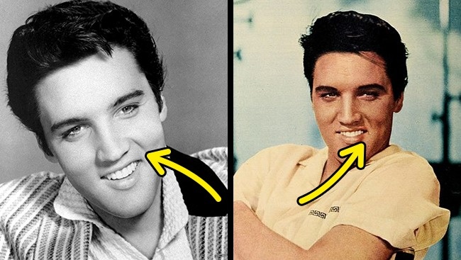 Cơ nâng môi trên 