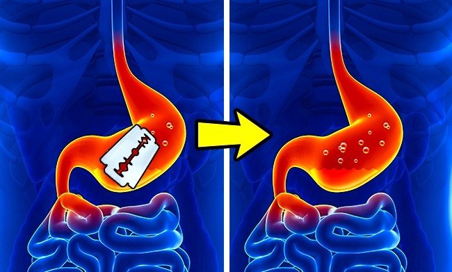 Axit trong dạ dày đủ để "phân hủy" được cả một chiếc lưỡi dao cạo