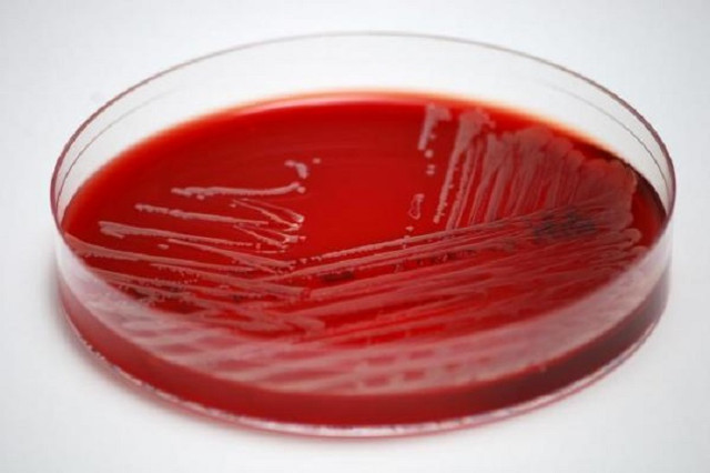 Sử dụng thuốc statin có thể làm giảm nguy cơ nhiễm trùng máu nguy hiểm