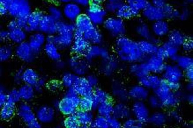 Mô hình sinh học bộ não nhỏ của con người tiết lộ những ảnh hưởng của ảo giác