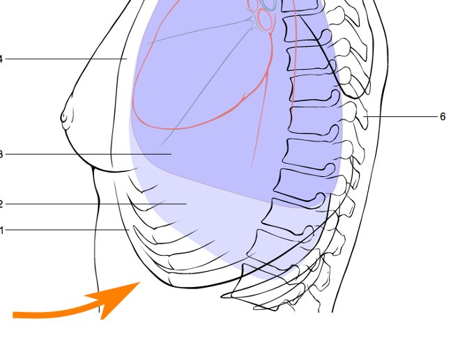 Bạn có thể thực hiện thủ thuật chống hóc Heimlich - đẩy bụng cho chính mình.