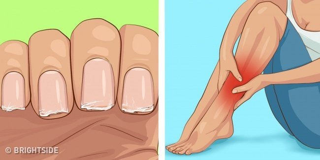 Thiếu hụt vitamin