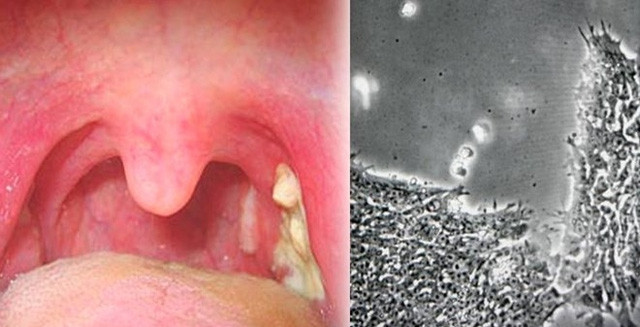 Bạn có thể bị nhiễm bệnh "ngu ngốc"