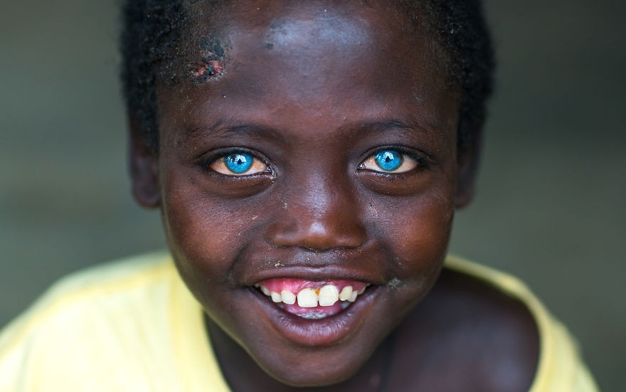 Có đôi mắt xanh