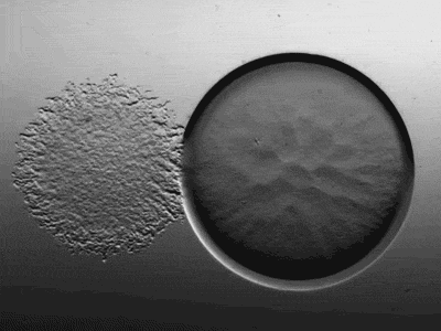 Tế bào vi khuẩn nhiều gấp 10 lần tế bào con người trong cơ thể