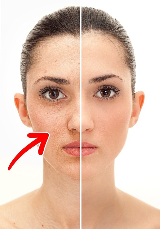 Làm chậm quá trình lão hóa