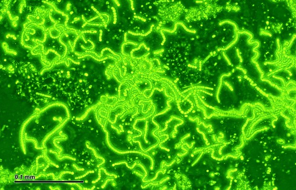 Khuẩn lam - Cyanobacteria có thể tồn tại trong điều kiện khắc nghiệt nhất.