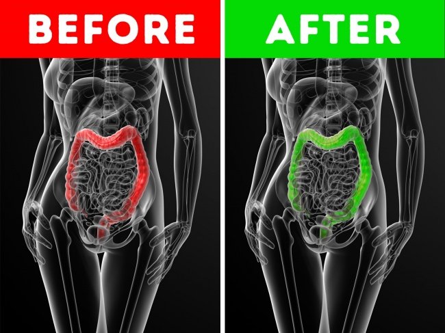 Chữa lành ruột kết