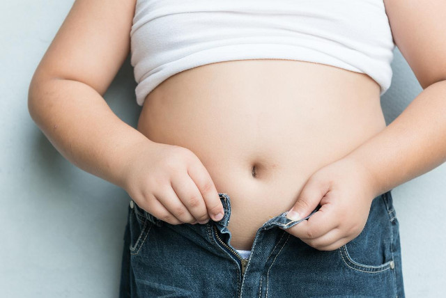 Chăm sóc răng miệng có thể bảo vệ con bạn khỏi chứng béo phì