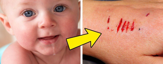 Nước bọt của con người có thể chữa lành vết thương