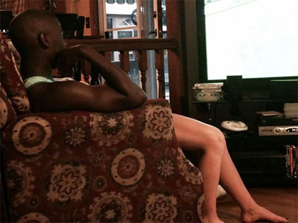 Tác hại khi không dùng kem chống nắng 