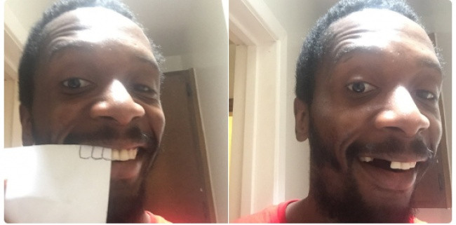 Cần gì phải đến nha khoa chứ!