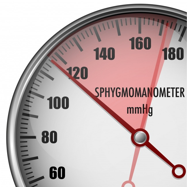 Huyết áp cao