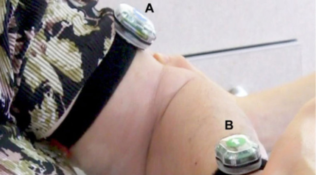 Dụng cụ mới đeo cổ tay giúp theo dõi thói quen ngủ của bạn