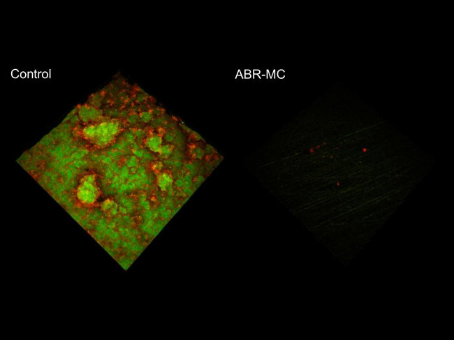 Vật liệu nha khoa mới giúp chống mảng bám, giết chết vi khuẩn