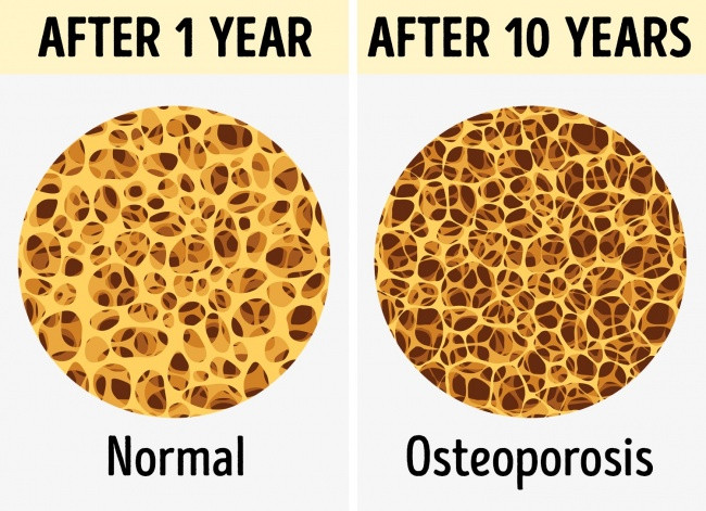 Suy yếu cơ bắp và xương