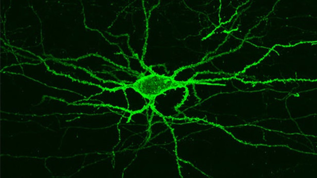 Kỹ thuật hình ảnh của MIT làm sáng tỏ hoạt động điện não