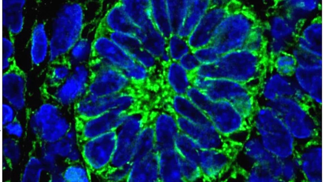 Tạo thành công mô thận người từ tế bào gốc