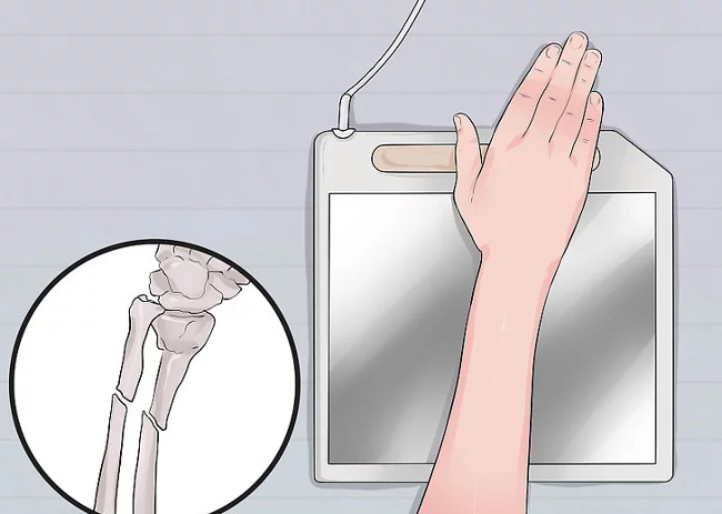 Chụp X-quang do bác sĩ chỉ định