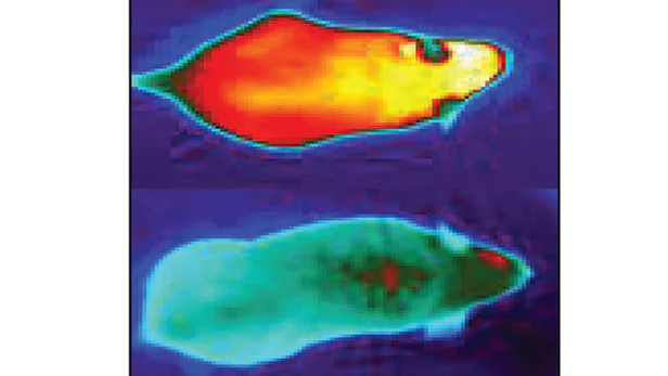 Khoa học xác định gen có khả năng đốt cháy chất béo nâu