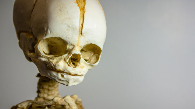 Người phụ nữ "hạ sinh trong quan tài" sau khi được chôn cất