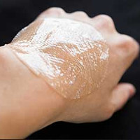 Hydrogel có thể giúp lành vết loét tiểu đường