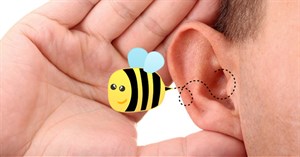Headphone, tai nghe bị rè, nhiễu, khó nghe và cách khắc phục?