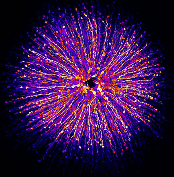 Võng mạc của Hanen Khabou