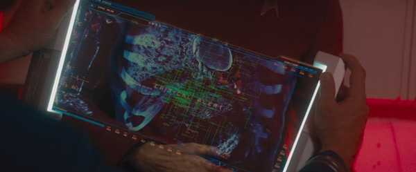 Diagnostic Wrap – Tấm Dẻo Chẩn đoán được áp dụng công nghệ thực tại tăng cường để theo dõi trạng thái người bệnh