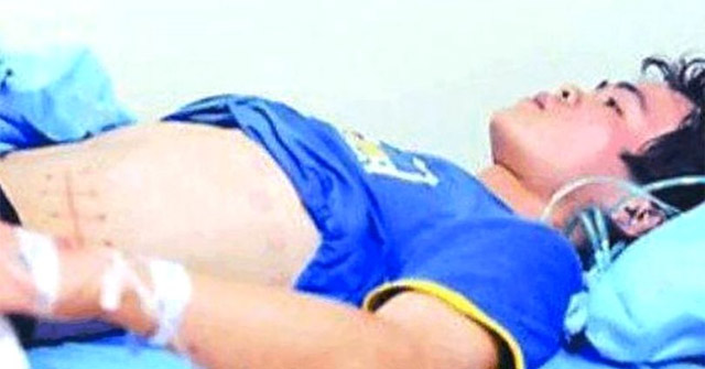 Đã 7 năm trôi qua nhưng Xiao Wang vẫn phải năm viện để chạy thận bằng máy