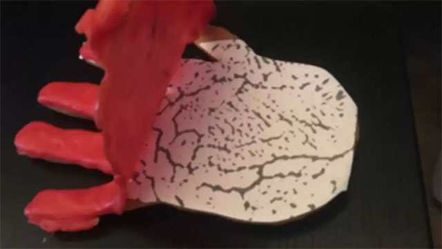 Cấu trúc tĩnh mạch của bạn vẫn có thể bị đánh cắp bình thường