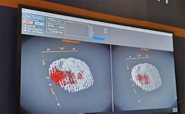 Thiết bị đeo giúp giảm stress