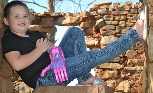 Tay giả bằng công nghệ in 3D