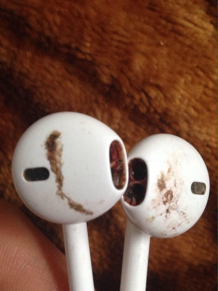 Hình ảnh kinh khủng về việc cho người ở bẩn mượn tai nghe 10