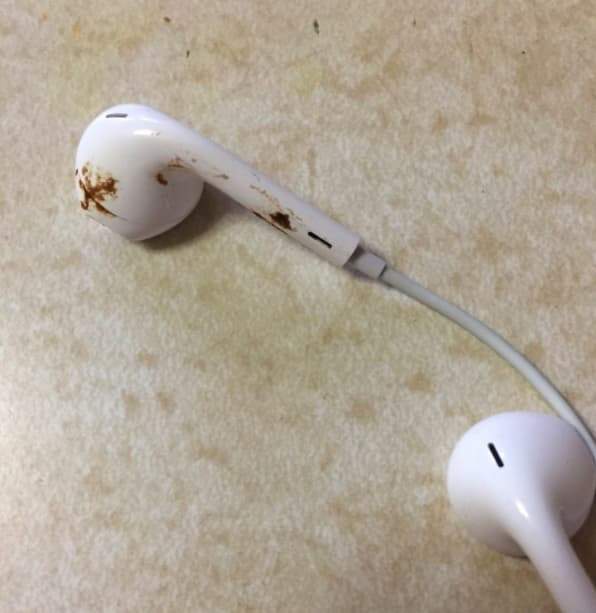 Hình ảnh kinh khủng về việc cho người ở bẩn mượn tai nghe 11