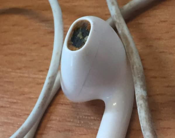 Hình ảnh kinh khủng về việc cho người ở bẩn mượn tai nghe