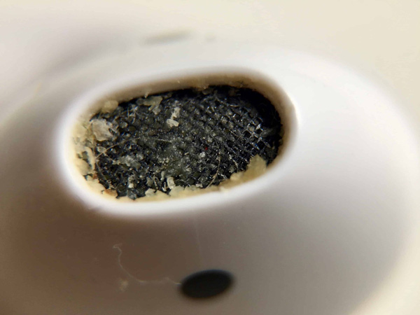 Hình ảnh kinh khủng về việc cho người ở bẩn mượn tai nghe 7