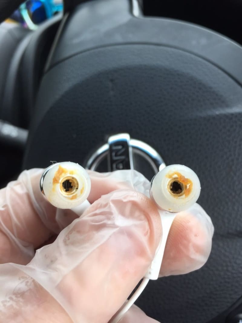 Hình ảnh kinh khủng về việc cho người ở bẩn mượn tai nghe 8