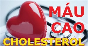 Làm thế nào để giảm cholesterol trong máu hiệu quả ?