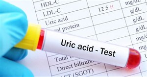 Tăng acid uric máu là bệnh gì? Tìm hiểu nguyên nhân, triệu chứng, chẩn đoán và cách điều trị