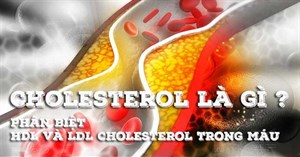 Cholesterol là gì? Phân biệt cholesterol tốt và cholesterol xấu trong cơ thể