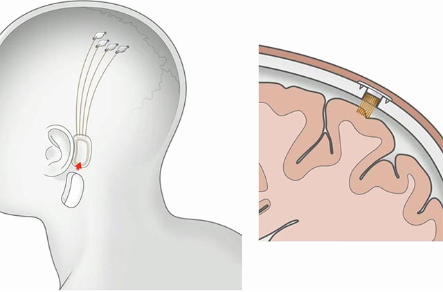 Chi phí "bảo dưỡng" liệu có phải là vấn đề lớn?