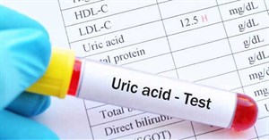 Chỉ số acid uric trong máu thấp có nguy hiểm không?