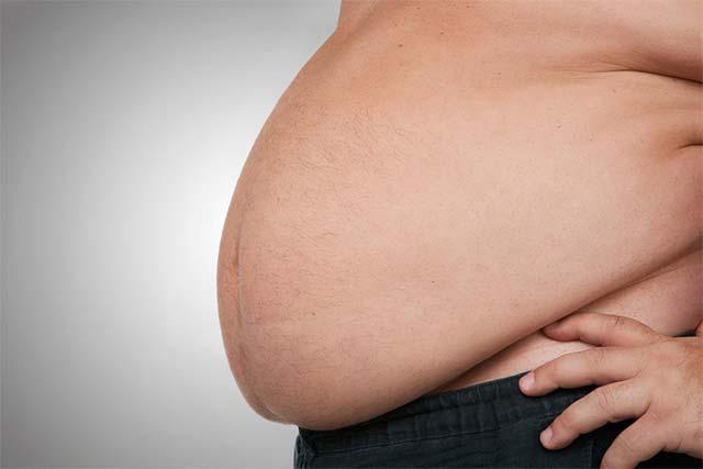 Béo phì là tình trạng cơ thể tích lũy lượng mô mỡ quá mức cần thiết