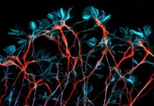 Can thiệp vào hoạt động của tế bào thần kinh MCH có thể là biện pháp cải thiện hiệu suất trí nhớ