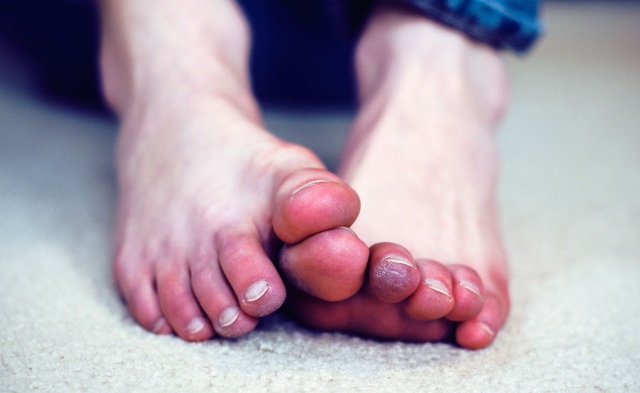 lạnh chân gây bệnh gì