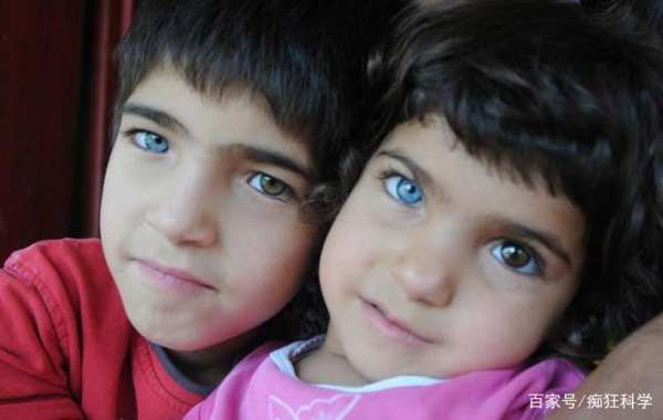 Trên thế giới có một số người sở hữu cặp mắt có 2 màu khác biệt