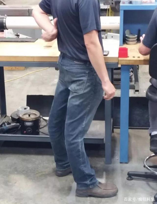 Do bẩm sinh của cơ thể mà “dị nhân” này có đầu gối cong vào trong chứ không hướng ra ngoài như bình thường