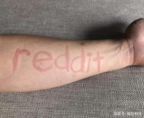 Dùng tay viết chữ lên da của mình