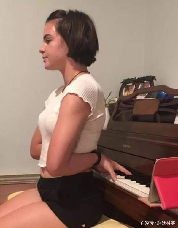 Vặn ngược khuỷu tay